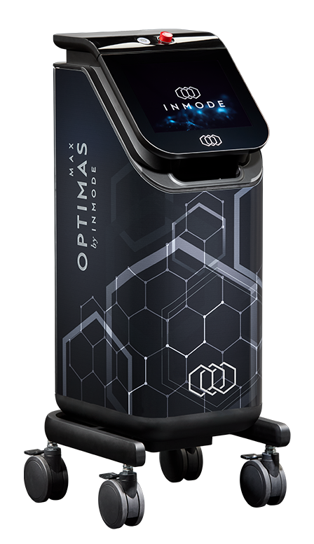 OptimasMAX