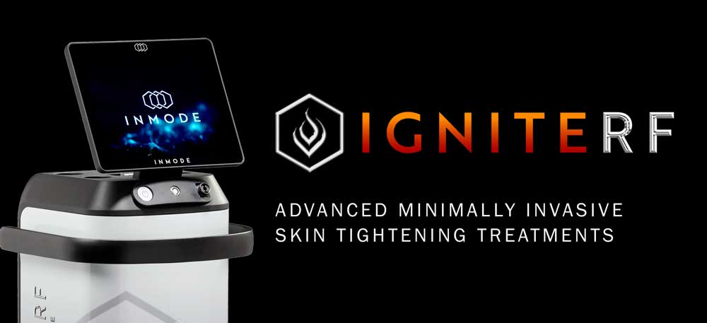 IgniteRF
